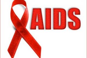 علائم ابتلا به HIV ایدز چیست؟